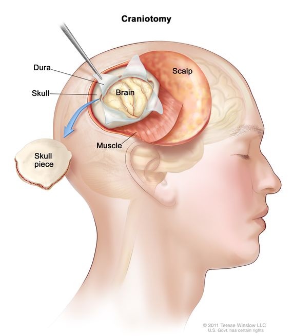 Anatomy of the Skull and Brain