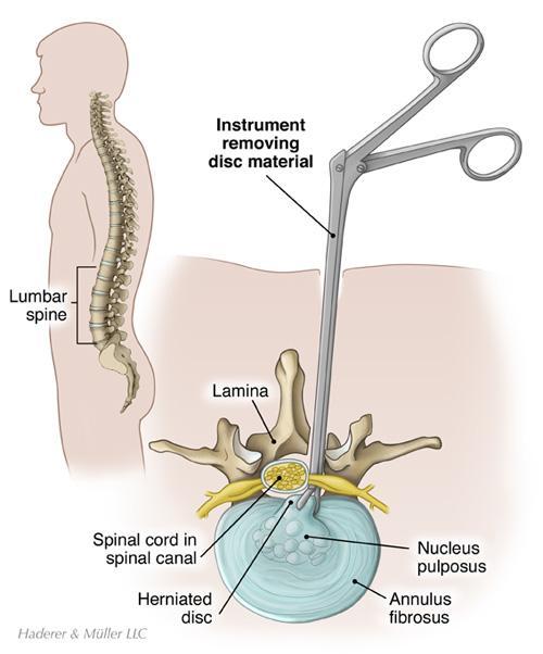 Lumbar spine anatomy